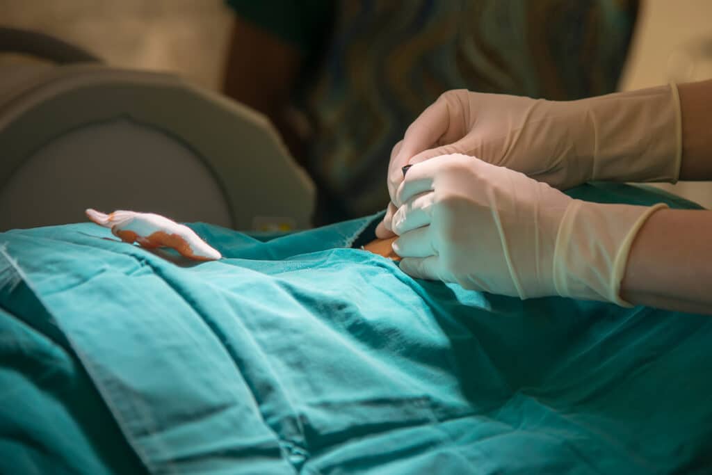 Surgical team preparing for image-guided injection procedure with sterile draping and gloved hands